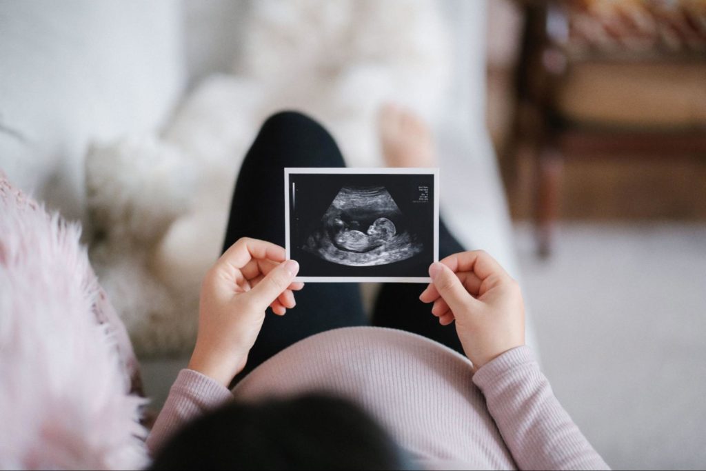 Busting Myths on Ultrasounds